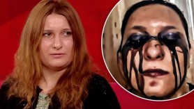 VIDEO // Viață de coșmar pentru o tânără din Strășeni. Îi curge sânge din ochi